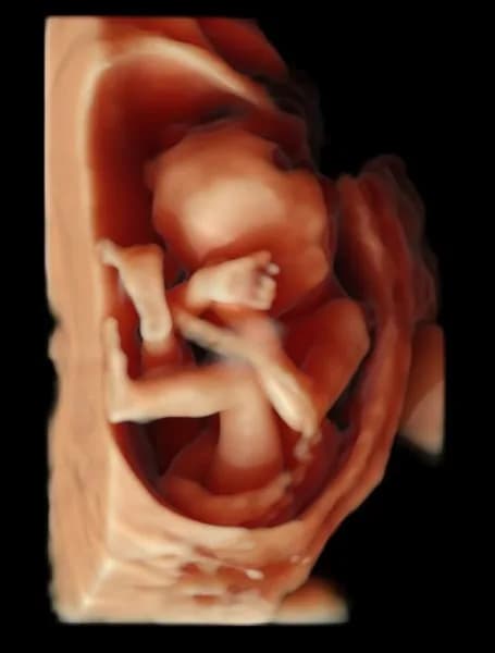 Massengo Athanase - photo 4