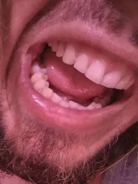 Dentiste Carenco Gosier