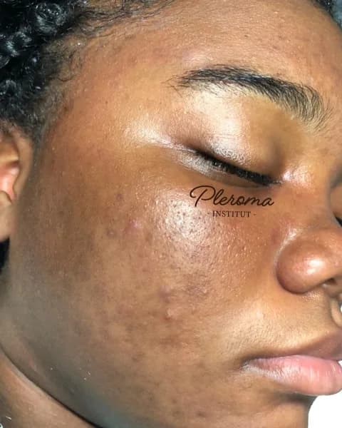 Institut Parallèle Gosier - photo 4